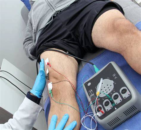 Neuromuskulárna diagnostika elektromyografia
