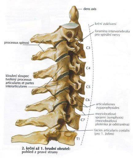 Osteofyty krčnej chrbtice a kompresia C6