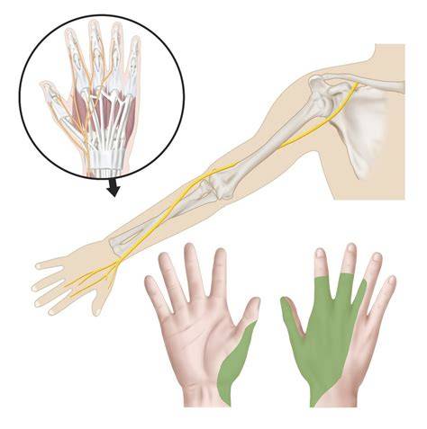 Anatómia priebehu nervus radialis