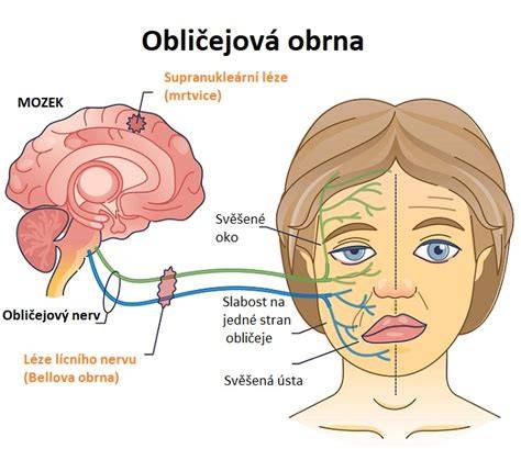 Tvárový nerv a Bellova obrna schéma