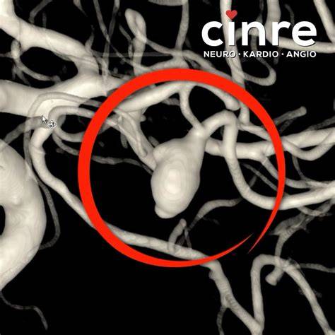 pacient na neurologickej infúznej liečbe
