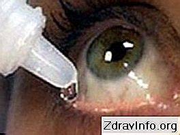 očné kvapky a schéma zníženia vnútroočného tlaku