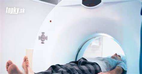 Dieťa počas transkraniálnej magnetickej stimulácie