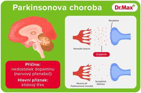 Parkinsonova choroba extrapyramídový systém