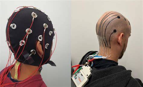 Elektródy EEG na pokožke hlavy
