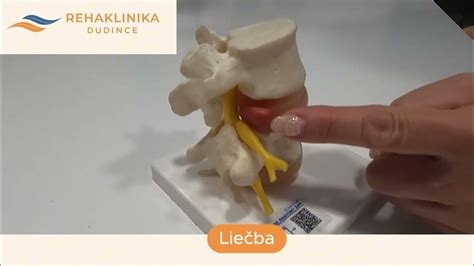 Priebeh lumbálnej punkcie v driekovej chrbtici