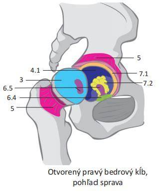 Artróza zdravý a poškodený kĺb