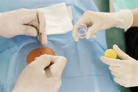Komplexná mamodiagnostika a biopsia prsníka