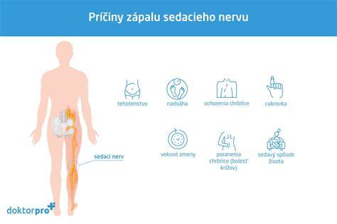 Schéma priebehu sedacieho nervu