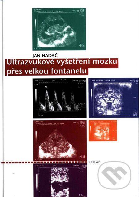 Ultrazvuk mozgu cez veľkú fontanelu