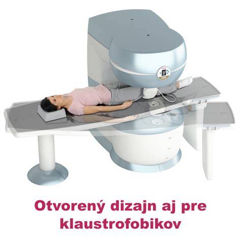 otvorená magnetická rezonancia končatiny O-scan