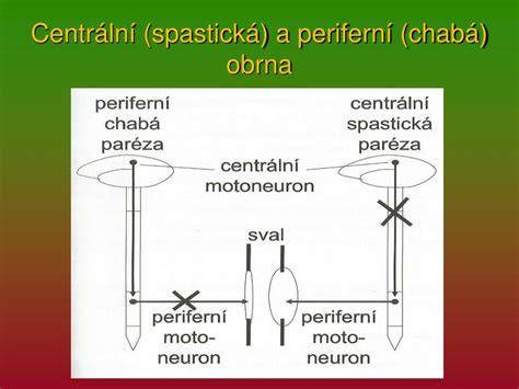 Akútna chabá obrna anatomické postihnutie
